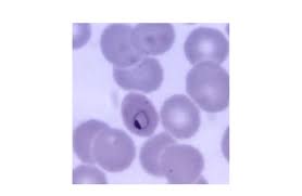 Attēlu rezultāti vaicājumam “Reticularia lobata plasmodium”