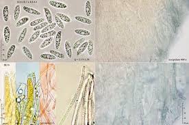 Attēlu rezultāti vaicājumam “Hymenoscyphus calyculus”