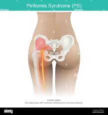 Attēlu rezultāti vaicājumam “Cribraria piriformis stalked”