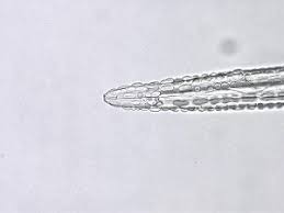 Attēlu rezultāti vaicājumam “Gulielmina vermicularis”