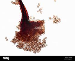 Attēlu rezultāti vaicājumam “Lignydium muscorum spores”