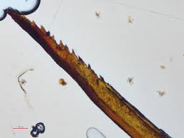 Attēlu rezultāti vaicājumam “Timmia megapolitana”