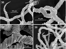 Attēlu rezultāti vaicājumam “Trichia alpina sessile”