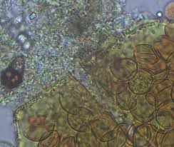Attēlu rezultāti vaicājumam “Licea castanea spores”