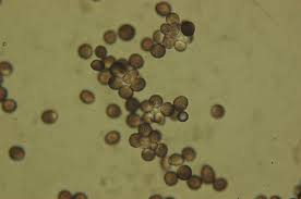 Attēlu rezultāti vaicājumam “Microbotryum tragopogonis - pratensis”