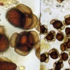 Attēlu rezultāti vaicājumam “Urocystis anemones spores”