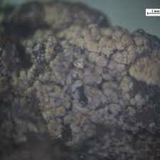 Attēlu rezultāti vaicājumam “Claustria didermoides spores”