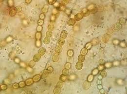 Attēlu rezultāti vaicājumam “Nostoc pruniforme macro”