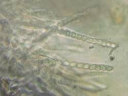 Attēlu rezultāti vaicājumam “Hypocrea pulvinata”