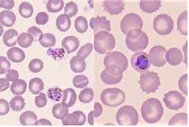 Attēlu rezultāti vaicājumam “Enteridium variabile plasmodium”