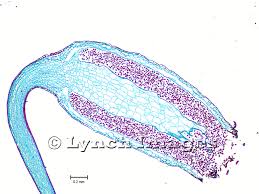 Attēlu rezultāti vaicājumam “Mnium hornum sporophyte”