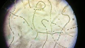 Attēlu rezultāti vaicājumam “Nostoc pruniforme cells”