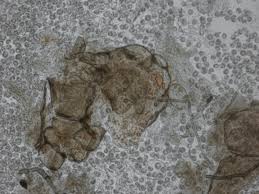 Attēlu rezultāti vaicājumam “Lycogala succineum macro”