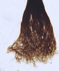 Attēlu rezultāti vaicājumam “Paradiacheopsis rigida stalked”