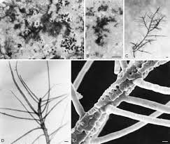 Attēlu rezultāti vaicājumam “Cystocoleus ebeneus”