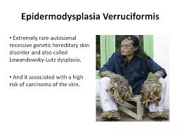 Image result for Lewandowsky-Lutz