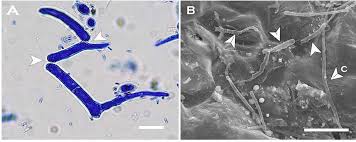Attēlu rezultāti vaicājumam “Mycosphaerella ulmi”