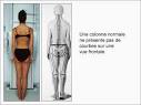 sont en <b>lordose</b> et les