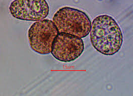 Attēlu rezultāti vaicājumam “Diderma ochraceum sessile”