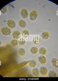 Attēlu rezultāti vaicājumam “Oligonema persimile macro”