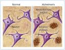 Plaques and Tangles