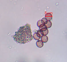 Attēlu rezultāti vaicājumam “Lycogala fuscoolearium macro”