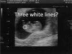 Due in November, we have our Due date Buddies Thread! - In-