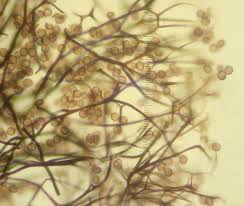 Attēlu rezultāti vaicājumam “Lamproderma nigrescens”