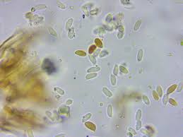 Attēlu rezultāti vaicājumam “Crustoderma dryinum”