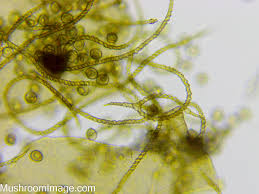 Attēlu rezultāti vaicājumam “Trichia varia sessile”