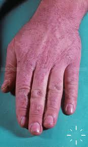 Image result for Lewandowsky-Lutz