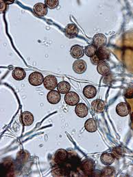 Attēlu rezultāti vaicājumam “Didymium melanospermum spores”