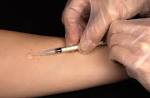 File:Mantoux <b>tuberculin</b> skin