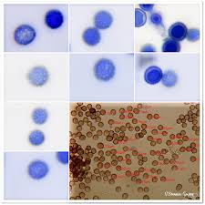 Attēlu rezultāti vaicājumam “Dianema depressum plasmodium”