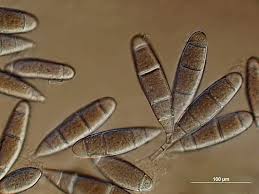 Attēlu rezultāti vaicājumam “Bactridium flavum”