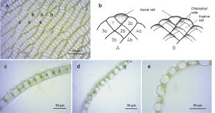 Attēlu rezultāti vaicājumam “Jungermannia hyalina cells”