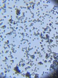 Attēlu rezultāti vaicājumam “Reticularia lycoperdon spores”