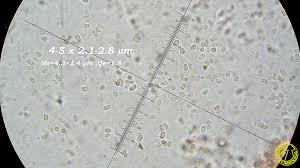 Attēlu rezultāti vaicājumam “Mucronella calva”