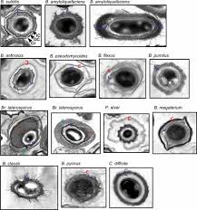 Attēlu rezultāti vaicājumam “Enteridium corticatum spores”