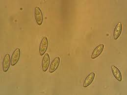 Attēlu rezultāti vaicājumam “Byssonectria fusispora”