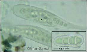 Attēlu rezultāti vaicājumam “Plectocarpon lichenum”