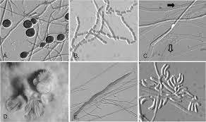 Attēlu rezultāti vaicājumam “Oxyporus corticola”