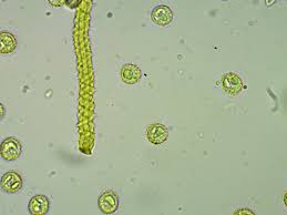 Attēlu rezultāti vaicājumam “Hemitrichia leiotricha spores”