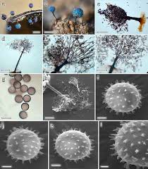 Attēlu rezultāti vaicājumam “Paradiacheopsis rigida spores”