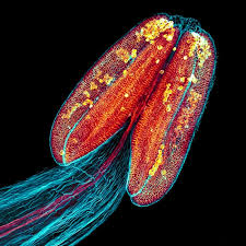 Attēlu rezultāti vaicājumam “Diderma subviridifuscum var. macrospora* spores”