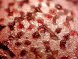 Attēlu rezultāti vaicājumam “Lycogala persicum macro”