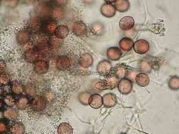 Attēlu rezultāti vaicājumam “Physarum gravidum stalked”