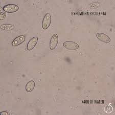 Attēlu rezultāti vaicājumam “Fuligo gyrosa spores”