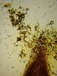 Attēlu rezultāti vaicājumam “Physarum nitens spores”