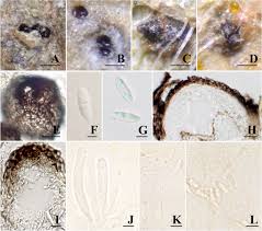 Attēlu rezultāti vaicājumam “Coleosporium sp.”